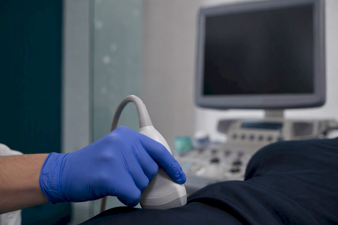 Gloved hand holding an ultrasound transducer beside a patient