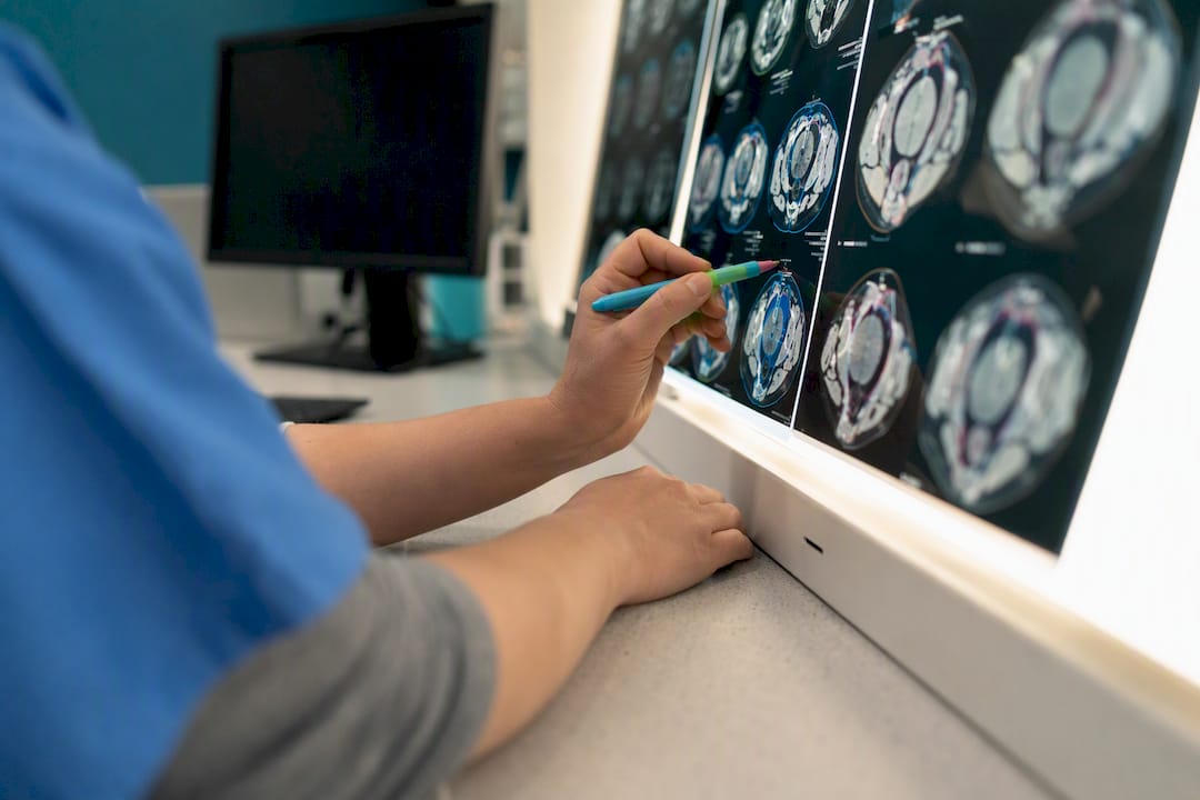 Hands marking flagged radiology films