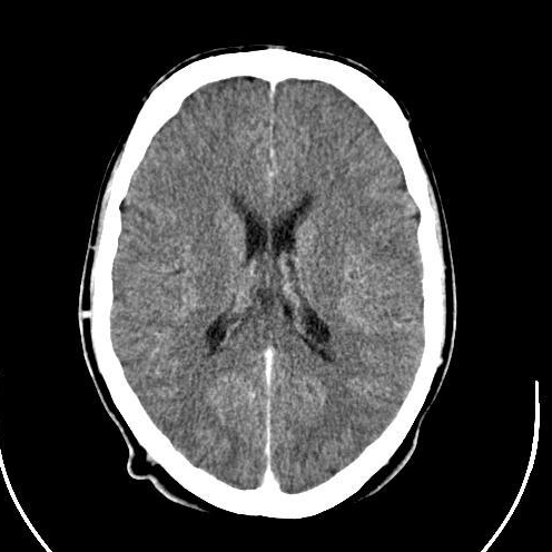 Axial CT slice arriving in the reading queue