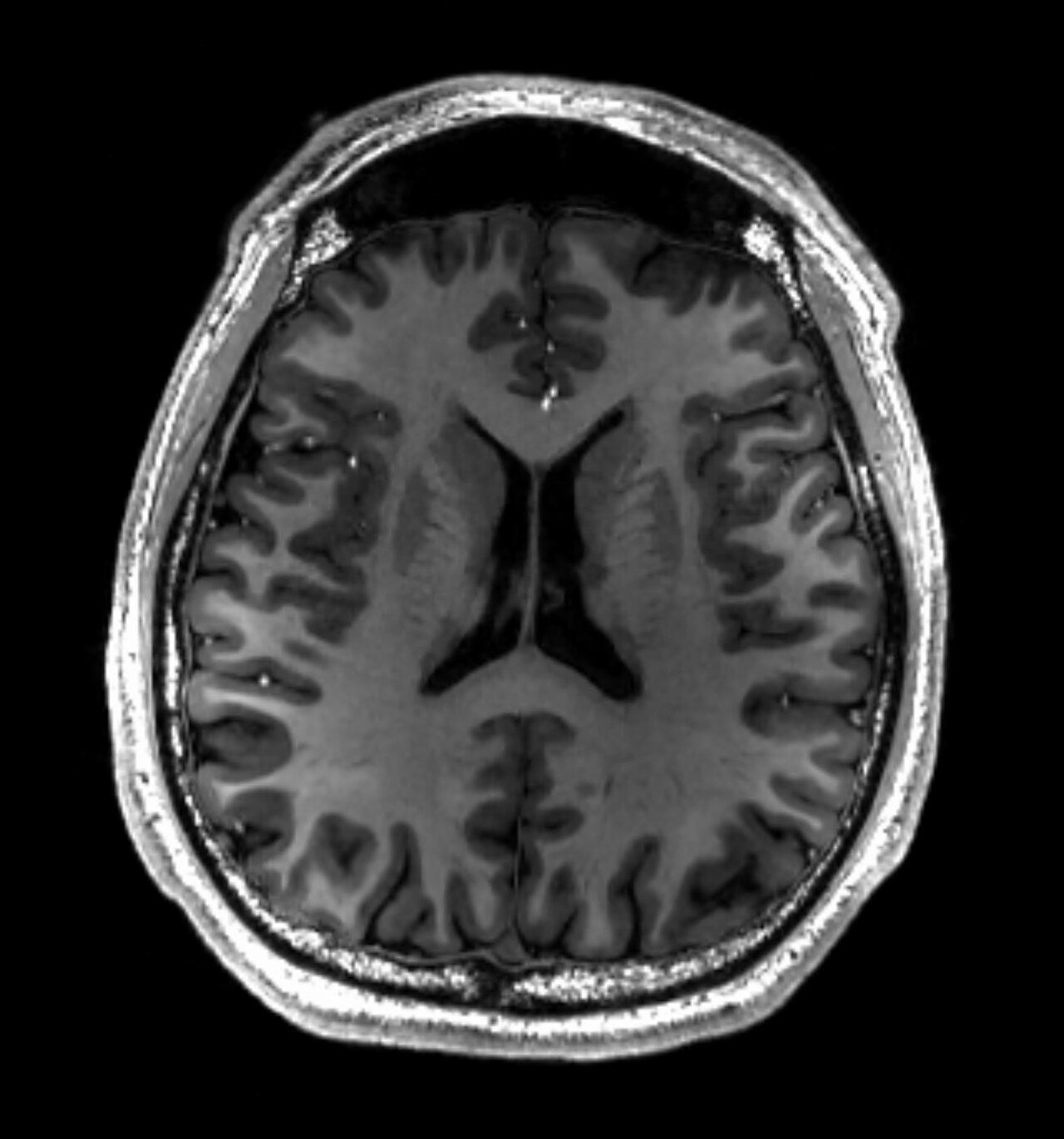 Brain MRI slice on a reading workstation